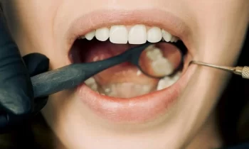 Perché la prima visita ortodontica è importante entro il primo anno di vita?