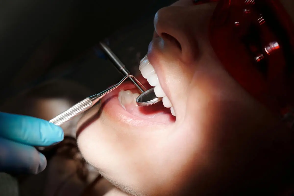 Intarsio dentale