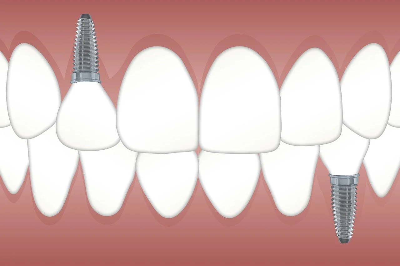 Odontoiatria Conservativa