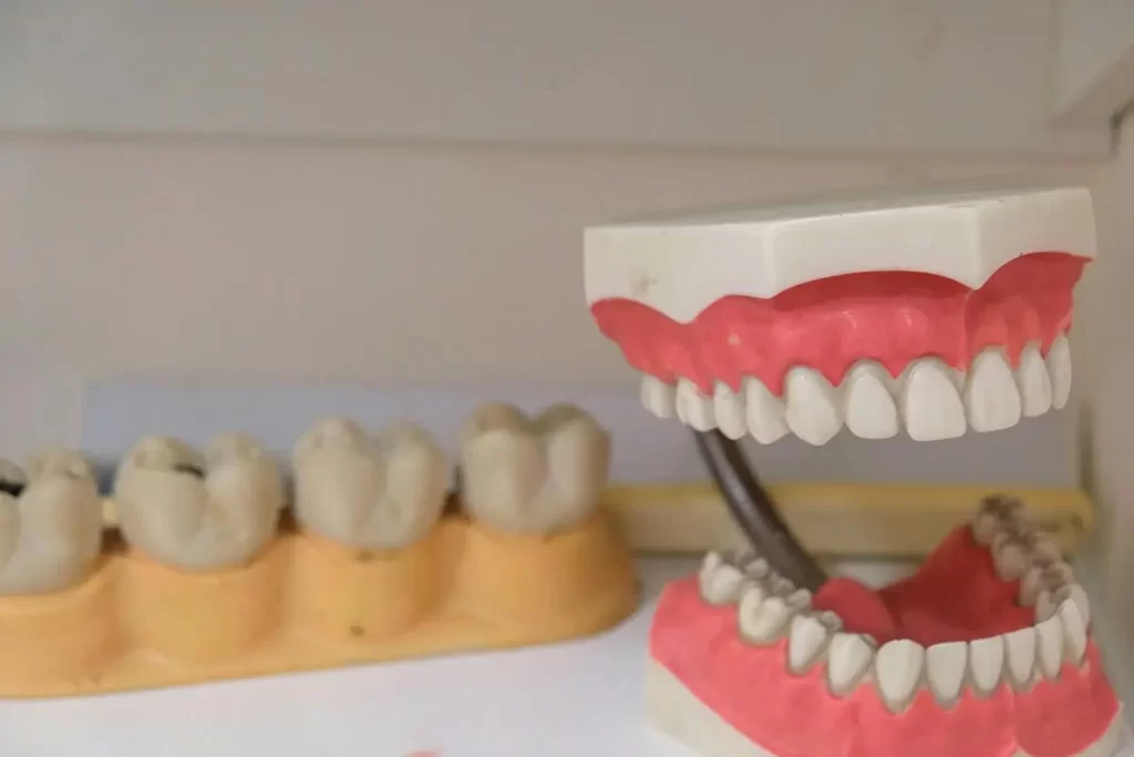 Intarsio dentale