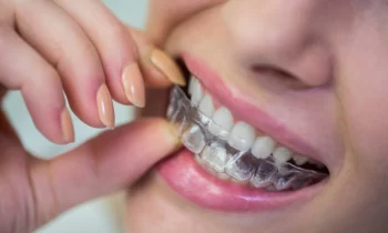 invisalign