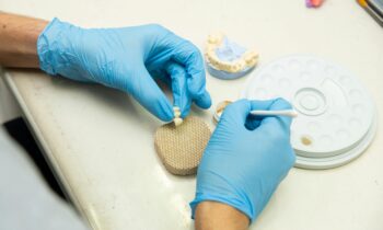 Processo-di-Realizzazione-delle-Protesi-dentali--Fisse-Metallo-Ceramiche (1)