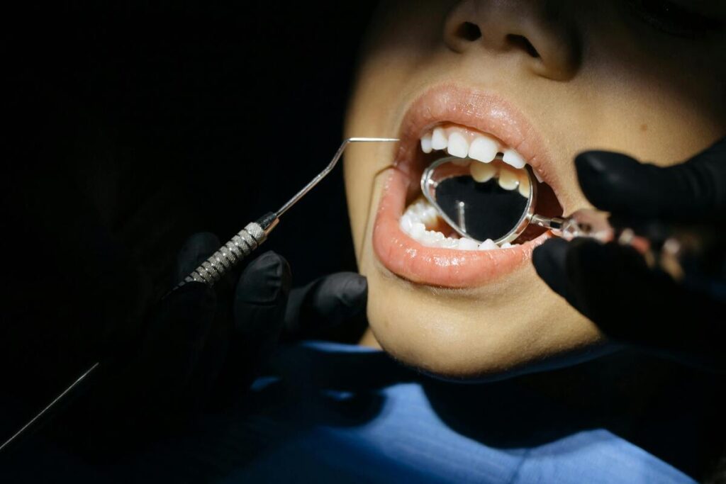 La carie secca, nota anche come carie arrestata, è una forma di carie dentale che, pur essendo visibile, non è più attiva.